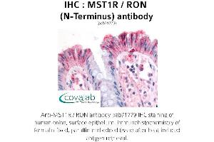 Image no. 1 for anti-Macrophage Stimulating 1 Receptor (C-Met-Related tyrosine Kinase) (MST1R) (N-Term) antibody (ABIN1737098) (MST1R anticorps  (N-Term))