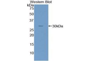 Western blot analysis of the recombinant protein. (NUP107 anticorps  (AA 554-784))