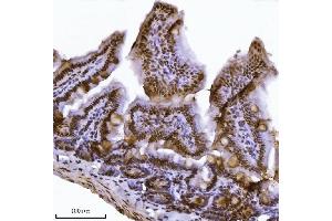 IHC analysis of JHDM3A/JMJD2A/KDM4A using anti-JHDM3A/JMJD2A/KDM4A antibody (ABIN7601534). (KDM4A anticorps  (AA 379-1064))