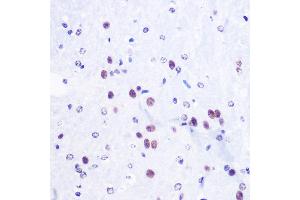 Immunohistochemistry of paraffin-embedded Mouse brain using TriMethyl-Histone H3-K36 Rabbit pAb (ABIN3016038, ABIN3016039, ABIN3016040, ABIN1680217 and ABIN6219525) at dilution of 1:100 (40x lens).