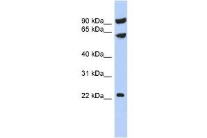TIGD3 antibody used at 1 ug/ml to detect target protein. (TIGD3 anticorps  (Middle Region))