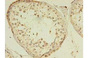 Immunohistochemistry of paraffin-embedded human testis tissue using ABIN7175077 at dilution of 1:100 (C1ORF53 anticorps  (AA 46-116))