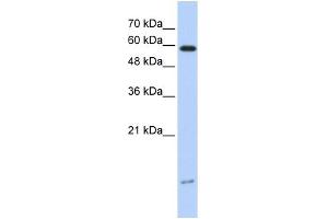WB Suggested Anti-DYNLL1 Antibody Titration: 0.