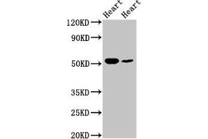 Western Blot Positive WB detected in: Rat heart tissue, Mouse heart tissue All lanes: ILK antibody at 5 μg/mL Secondary Goat polyclonal to rabbit IgG at 1/50000 dilution Predicted band size: 52, 45, 37 kDa Observed band size: 52 kDa (ILK anticorps  (AA 1-228))