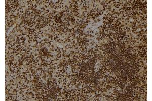 ABIN6257900 and ABIN6275491 at 1/100 staining Rat spleen tissue by IHC-P.