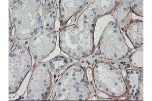 Immunohistochemical staining of paraffin-embedded Human Kidney tissue using anti-LDLRAP1 mouse monoclonal antibody. (LDLRAP1 anticorps)