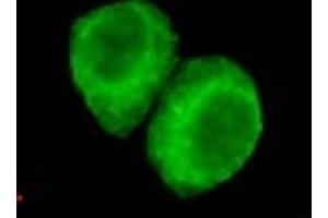 Immunocytochemistry of HeLa cells using anti-JMJD6(N-terminus) mouse mAb diluted 1:200. (JMJD6 anticorps  (N-Term))