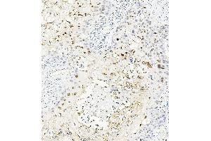 IHC analysis of MAFA using anti-MAFA antibody (ABIN7602623). (MAFA anticorps  (AA 9-308))