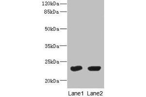 Western Blot All lanes: UBE2T antibody at 10 μg/mL Lane 1: HepG2 whole cell lysate Lane 2: Hela whole cell lysate Secondary Goat polyclonal to rabbit IgG at 1/10000 dilution Predicted band size: 23 kDa Observed band size: 23 kDa (Ube2t anticorps  (AA 1-197))