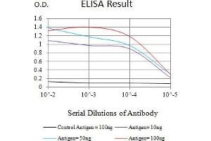 Black line: Control Antigen (100 ng),Purple line: Antigen (10 ng), Blue line: Antigen (50 ng), Red line:Antigen (100 ng)