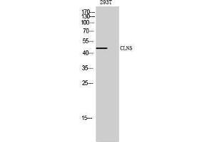 Western Blotting (WB) image for anti-Ceroid-Lipofuscinosis, Neuronal 5 (CLN5) (Internal Region) antibody (ABIN3174448) (CLN5 anticorps  (Internal Region))