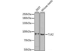 Western blot analysis of extracts of various cell lines using TLK2 Polyclonal Antibody at dilution of 1:1000. (TLK2 anticorps)