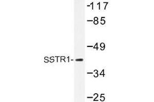 Image no. 1 for anti-Somatostatin Receptor 1 (SSTR1) antibody (ABIN317866) (SSTR1 anticorps)