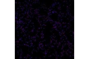 Immunofluorescent analysis of paraformaldehyde-fixed mouse lung using,PNN (ABIN7075083) at dilution of 1: 800