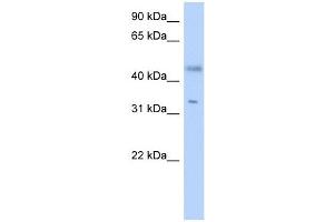 RDHE2 antibody used at 1 ug/ml to detect target protein. (SDR16C5 anticorps  (Middle Region))