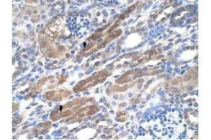 KIAA0319 antibody was used for immunohistochemistry at a concentration of 4-8 ug/ml to stain Epithelial cells of renal tubule (arrows) in Human Kidney.