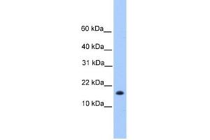 WB Suggested Anti-C6orf173 Antibody Titration: 0. (CENPW anticorps  (N-Term))