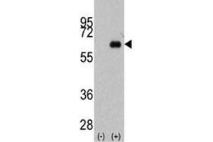 Western blot analysis of anti-Myc antibody and 293 cell lysate (2 ug/lane) either nontransfected (Lane 1) or transiently transfected with the MYC gene (2).