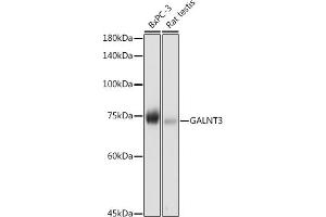Western blot analysis of extracts of various cell lines, using G antibody (ABIN6131444, ABIN6140942, ABIN6140944 and ABIN6218180) at 1:1000 dilution. (GALNT3 anticorps  (AA 1-140))