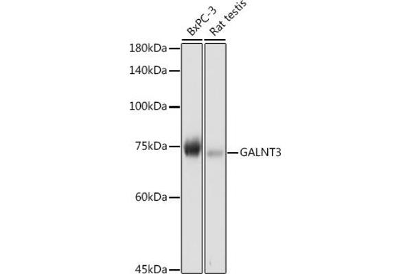 GALNT3 anticorps  (AA 1-140)