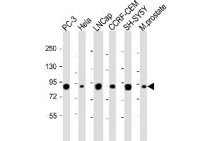 All lanes : Anti-TGM4 Antibody (Center) at 1:1000-1:2000 dilution Lane 1: PC-3 whole cell lysateLane 2: Hela whole cell lysate Lane 3: LNCap whole cell lysate Lane 4: CCRF-CEM whole cell lysate Lane 5: SH-SY5Y whole cell lysate Lane 6: Mouse prostate whole tissue lysate Lysates/proteins at 20 μg per lane. (TGM4 anticorps  (AA 135-164))