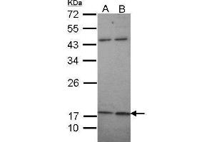 WB Image Sample (30 ug of whole cell lysate) A: A431 , B: H1299 12% SDS PAGE antibody diluted at 1:1000 (KCNMB1 anticorps  (Center))