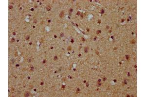 IHC image of ABIN7174180 diluted at 1:100 and staining in paraffin-embedded human brain tissue performed on a Leica BondTM system. (C16orf57 anticorps  (AA 1-90))