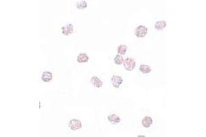 Immunohistochemistry (IHC) image for anti-SRY (Sex Determining Region Y)-Box 2 (SOX2) (N-Term) antibody (ABIN1031582) (SOX2 anticorps  (N-Term))