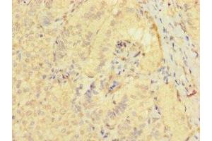 Immunohistochemistry of paraffin-embedded human adrenal gland tissue using ABIN7171870 at dilution of 1:100