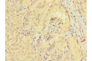Immunohistochemistry of paraffin-embedded human adrenal gland tissue using ABIN7171870 at dilution of 1:100 (TSPAN32 anticorps  (AA 111-202))