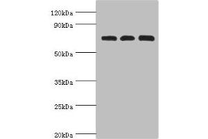 Western blot All lanes: Calcium-binding mitochondrial carrier protein Aralar2 antibody at 4 μg/mL Lane 1: Mouse liver tissue Lane 2: Mouse kidney tissue Lane 2: HepG2 whole cell lysate Secondary Goat polyclonal to rabbit IgG at 1/10000 dilution Predicted band size: 74 kDa Observed band size: 74 kDa (slc25a13 anticorps  (AA 1-300))