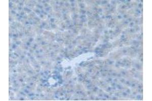 IHC-P analysis of Rat Liver Tissue, with DAB staining. (CEACAM1 anticorps  (AA 36-145))