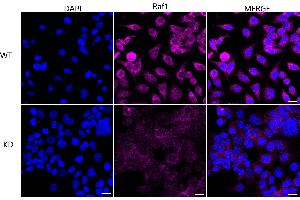 Immunocytochemical staining of HeLa cells using Raf1 antibody (ABIN7800800), 1:1,000), Top panel: wild-type (WT), Bottom panal: Raf1 shRNA knockdown (KD). (Recombinant RAF1 anticorps)