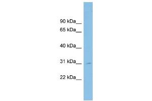 WB Suggested Anti-SPATA9 Antibody Titration: 0. (SPATA9 anticorps  (N-Term))