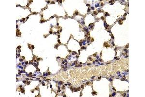 Immunohistochemistry of paraffin-embedded Mouse lung using WHSC1 Polyclonal Antibody at dilution of 1:100 (40x lens).