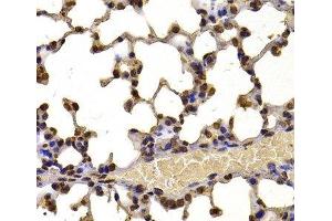 Immunohistochemistry of paraffin-embedded Mouse lung using WHSC1 Polyclonal Antibody at dilution of 1:100 (40x lens). (WHSC1 anticorps)