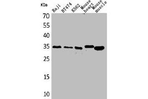 Western Blot analysis of Raji BT474 K562 mouse heart mouse skeletal muscle cells using Claudin-17 Polyclonal Antibody (Claudin 17 anticorps  (C-Term))