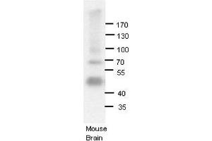 ADARB1 antibody - N-terminal region  validated by WB using Mouse brains at 1:1000.