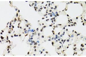 Immunohistochemistry of paraffin-embedded Mouse lung using EDF1 Polyclonal Antibody at dilution of 1:100 (40x lens). (EDF1 anticorps)