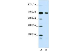WB Suggested Anti-TRIM32 Antibody Titration:  1. (TRIM32 anticorps  (N-Term))