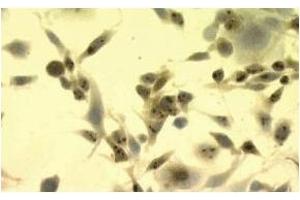 Immunohistochemistry (IHC) image for anti-Heat Shock Protein 70 (HSP70) antibody (ABIN263937) (HSP70 anticorps)