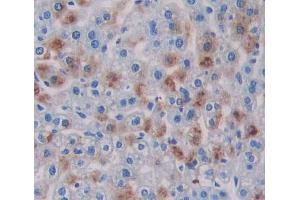 Used in DAB staining on fromalin fixed paraffin- embedded liver tissue