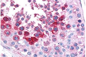 Human Testis: Formalin-Fixed, Paraffin-Embedded (FFPE) (LST1 anticorps)