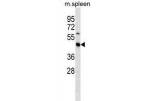 Western Blotting (WB) image for anti-STE20-Related Kinase Adaptor beta (STRADB) antibody (ABIN2998566)