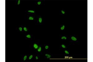Immunofluorescence of monoclonal antibody to CCNH on HeLa cell. (Cyclin H anticorps  (AA 1-110))