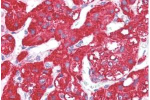 Anti-ACVR1 antibody IHC staining of human adrenal.