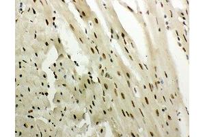 IHC-P: GR antibody testing of mouse heart tissue (GR (AA 20-199) anticorps)