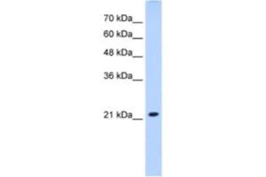 Western Blotting (WB) image for anti-Solute Carrier Family 25 (Mitochondrial Carrier, Brain), Member 14 (SLC25A14) antibody (ABIN2462743) (SLC25A14 anticorps)