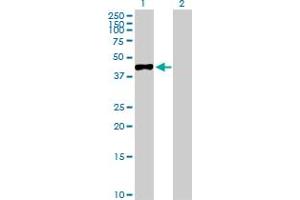 Western Blot analysis of MAGEA3 expression in transfected 293T cell line by MAGEA3 MaxPab polyclonal antibody. (MAGEA3 anticorps  (AA 1-314))