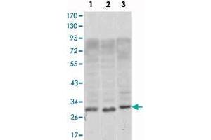 Western blot analysis using CD69 monoclonal antibody, clone 8B6  against, Jurkat (1), L1210 (2) and TPH-1 (3) cell lysate.